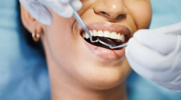 Best Same-Day Emergency Dental Services in Lake Wilderness, VA